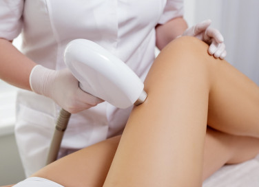 depilazione, laser, controindicazioni
