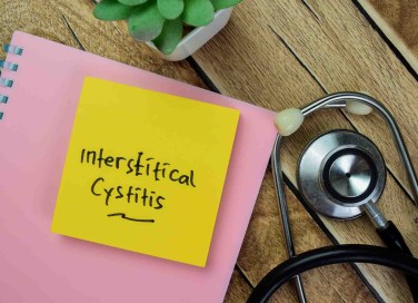 cistite interstiziale