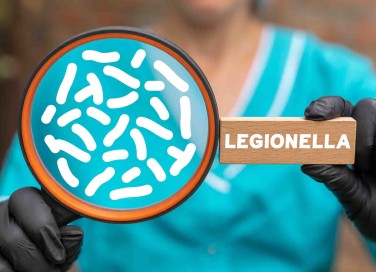 Legionella