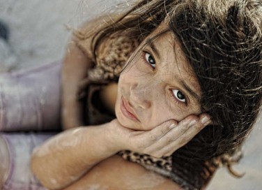 conseguenze della povertà di igiene