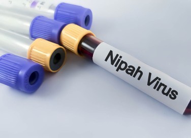virus Nipah