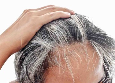 capelli bianchi