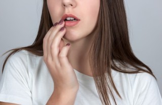 herpes labiale, rimedi naturali, cure