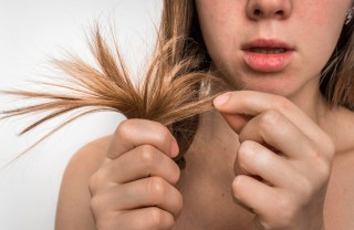 Vitamine per unghie e capelli più sani unghie, capelli