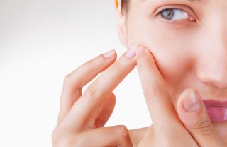 brufoli, rimedi naturali, acne viso