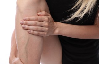 rimedi naturali, capillari fragili, vene varicose