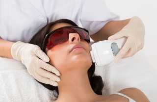 epilazione laser