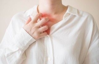 dermatite da sudore, rimedi naturali, trattamento