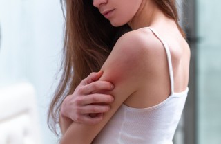 alleviare prurito dermatite