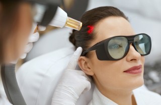 Laser per capelli Laser per capelli