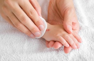 Come disinfettare un graffio