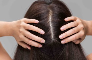 Cuoio capelluto irritato e dolorante