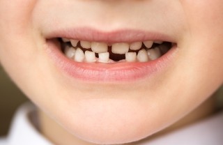denti dei bambini