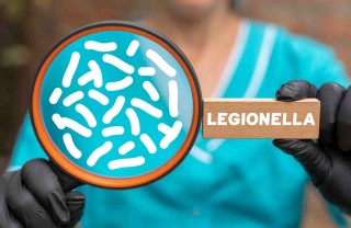 Legionella