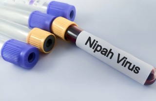 virus Nipah virus Nipah