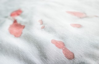 Come togliere le macchie di sangue dai tessuti