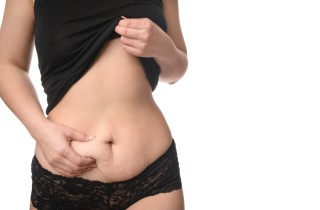 Episiotomia, come prendersi cura della pelle