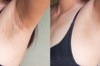 Come mai la pelle sotto le ascelle è scura?