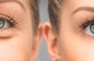 Borse sotto gli occhi: quali sono le cause?