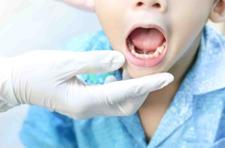 Lingua che brucia: cause e rimedi