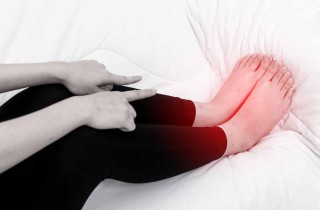 Gambe gonfie, le cause più comuni