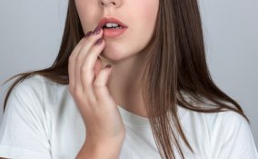 herpes labiale, rimedi naturali, cure