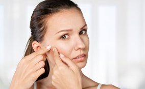 brufoli, rimedi naturali