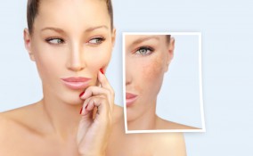 Laser Clear + Brilliant 