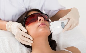 epilazione laser