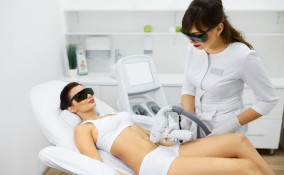 epilazione laser