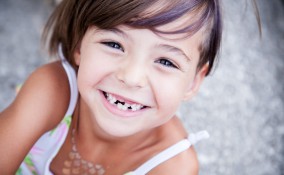 Crescita denti definitivi