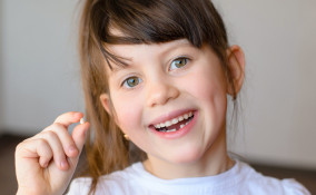 caduta denti da latte