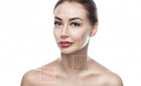 Rimedi naturali capillari