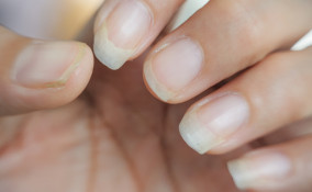 Salute delle unghie