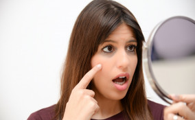 rimedi naturali occhiaie, come schiarirle, sgonfiarle