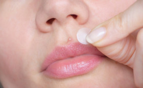 Cerotti idrocolloidali 