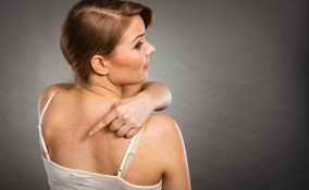 Orticaria