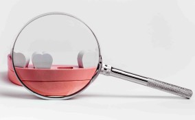 Sognare che cadono i denti