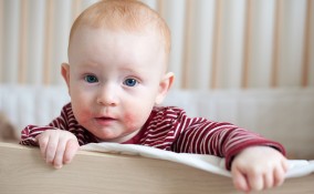 Dermatite atopica nei bambini: cause e rimedi