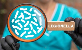 Legionella