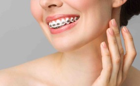 apparecchio dei denti