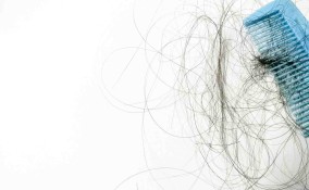 perdita e caduta di capelli