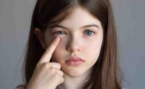 congiuntivite nei bambini
