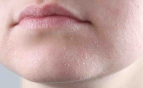 pelle ruvida con puntini