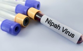 virus Nipah