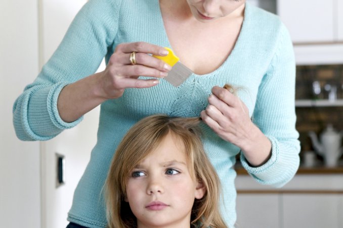 come eliminare i pidocchi