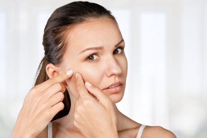 brufoli, rimedi naturali