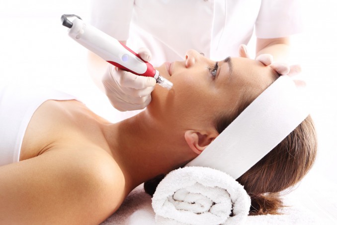 microneedling, rughe, trattamento