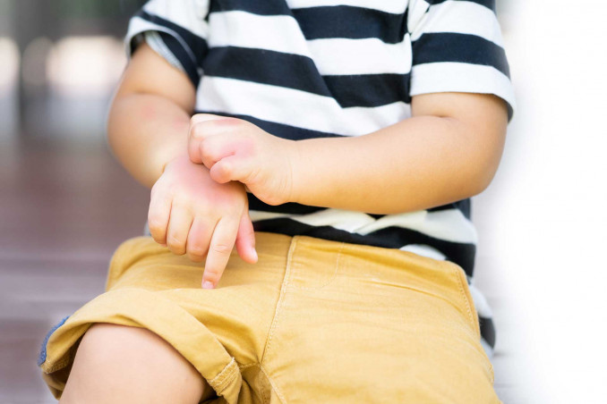 Zanzare vettori di malattie