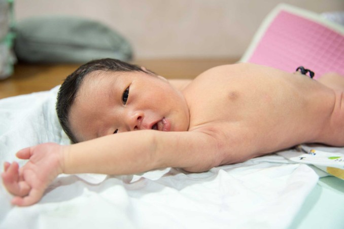 Come si cura il moncone ombelicale